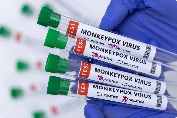 FACT CHECK Did US funded labs in Nigeria lead to monkeypox outbreak - Travel News, Insights & Resources.