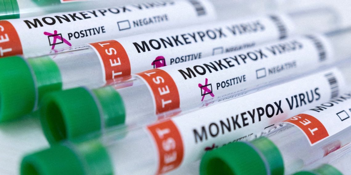 Hong Kong records first monkeypox case - Travel News, Insights & Resources.
